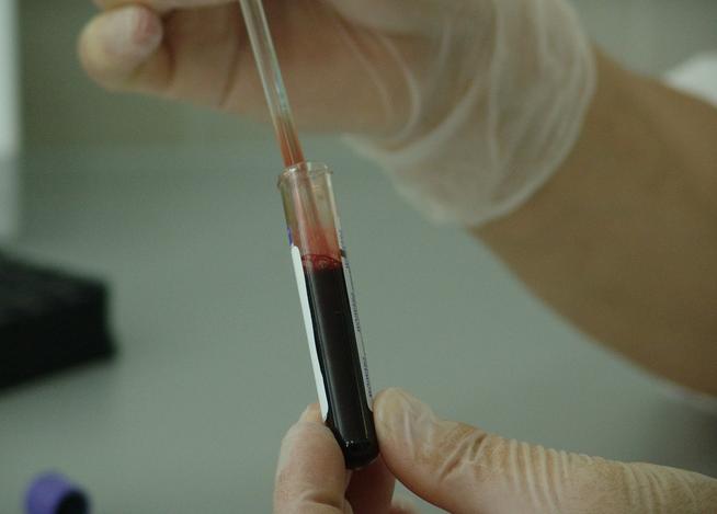 COVID: Here Come the Antibody Tests — Quick, Easy, and Insane